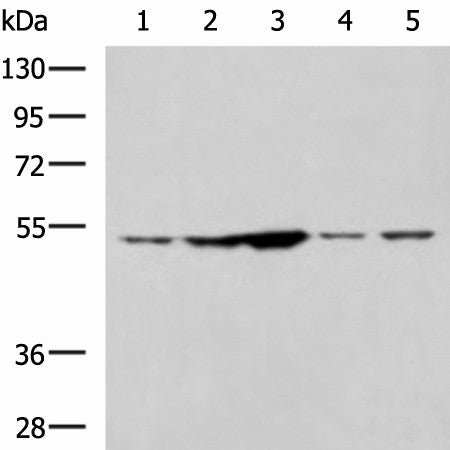 Western blot analysis of 293T and Jurkat cell lysates using SNTA1 Polyclonal Antibody at dilution of 1:1350