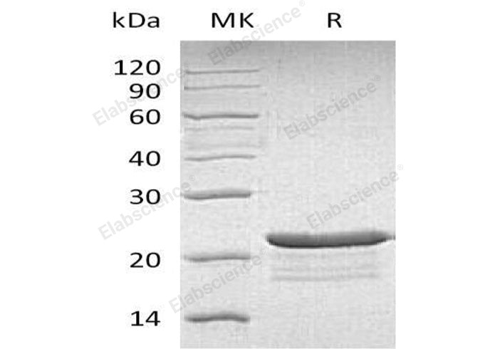 Recombinant Human PPP1R14A Protein (His Tag) - ABMIUM