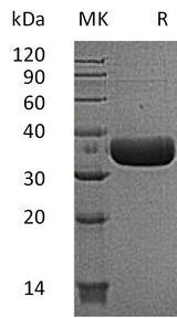Recombinant Mouse MCPT6/Mast Cell Protease-6 Protein (His Tag) - ABMIUM