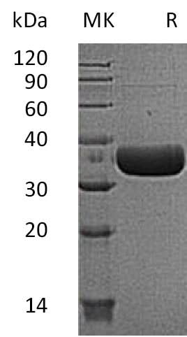 Recombinant Mouse MCPT6/Mast Cell Protease-6 Protein (His Tag) - ABMIUM