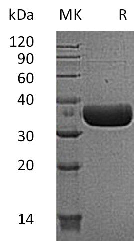 Recombinant Mouse MCPT6/Mast Cell Protease-6 Protein (His Tag) - ABMIUM