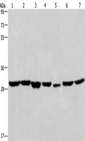Anti-Human/Mouse/Rat PHB Antibody - ABMIUM