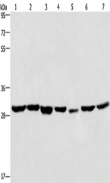 Anti-Human/Mouse/Rat PHB Antibody - ABMIUM