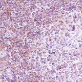 Anti-Human/Rat/Mouse VPAC2 Antibody [A391]