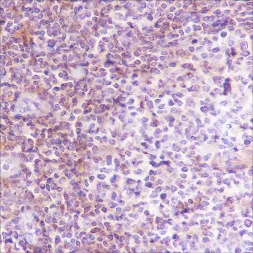 Anti-Human/Rat/Mouse VPAC2 Antibody [A391] - ABMIUM