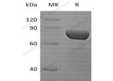 Recombinant Human DPP3 Protein (His Tag) - ABMIUM