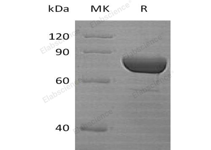 Recombinant Human DPP3 Protein (His Tag) - ABMIUM