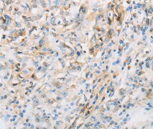 Anti-Human/Mouse/Rat NPPC Antibody