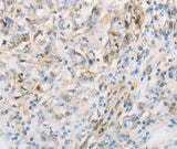 Anti-Human/Mouse/Rat NPPC Antibody - ABMIUM