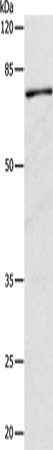 Anti-Human/Mouse/Rat CAPN1 Antibody - ABMIUM