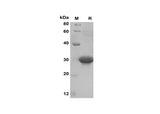 SDS-PAGE analysis of Mouse CXCL10 proteins, 2 μg/lane of Recombinant Mouse CXCL10 proteins was resolved with SDS-PAGE under reducing conditions, showing bands at 30 kDa.
