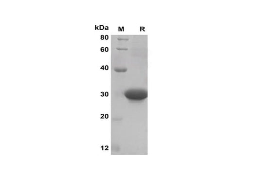 SDS-PAGE analysis of Mouse CXCL10 proteins, 2 μg/lane of Recombinant Mouse CXCL10 proteins was resolved with SDS-PAGE under reducing conditions, showing bands at 30 kDa.