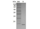 Recombinant Mouse S100A8/CAGA Protein (His Tag) - ABMIUM