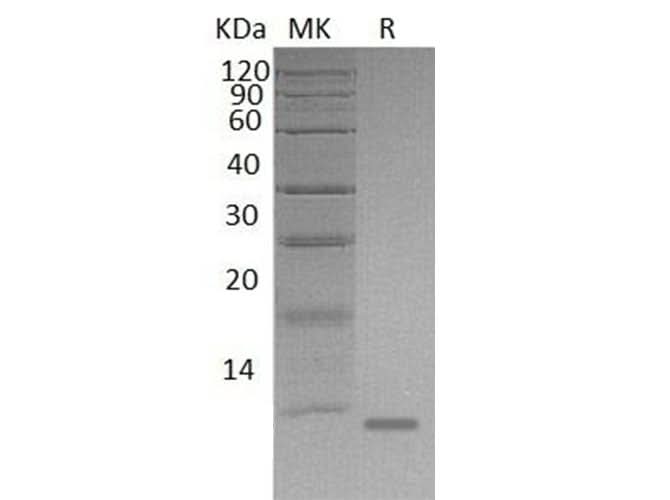 Recombinant Mouse S100A8/CAGA Protein (His Tag) - ABMIUM