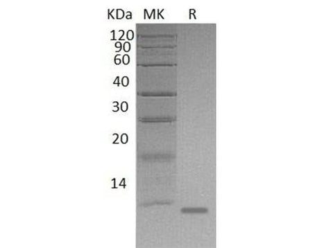Recombinant Mouse S100A8/CAGA Protein (His Tag) - ABMIUM