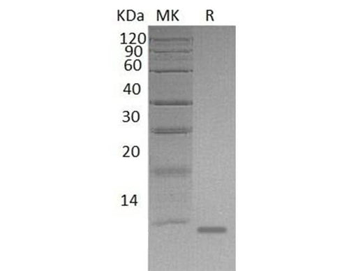 Recombinant Mouse S100A8/CAGA Protein (His Tag) - ABMIUM