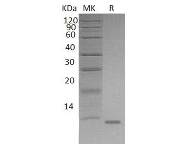 Recombinant Mouse S100A8/CAGA Protein (His Tag) - ABMIUM