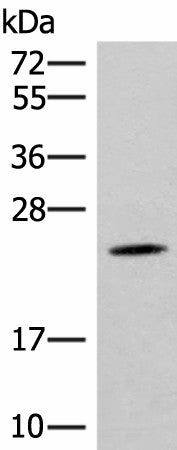 Western blot analysis of Mouse brain tissue lysate using TBPL1 Polyclonal Antibody at dilution of 1:400