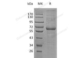 Recombinant Human LRP12 Protein (His Tag) - ABMIUM