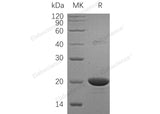 Recombinant Human NME1/NDKA Protein (His Tag) - ABMIUM