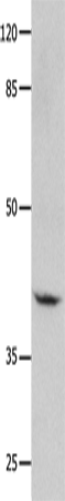 Anti-Human/Mouse/Rat GNA11 Antibody - ABMIUM