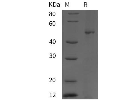 SDS-PAGE analysis of Human OPG proteins, 2 μg/lane of Recombinant Human OPG proteins was resolved with SDS-PAGE under reducing conditions, showing bands at 55 kDa.