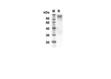 SDS-PAGE analysis of Human GPNMB proteins,, 2 μg/lane of Recombinant Human GPNMB proteins was resolved with SDS-PAGE under reducing conditions, showing bands at 75.9 kDa.