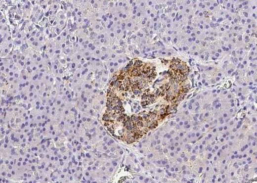 Anti-Human CX3CL1 Antibody [B117] - ABMIUM