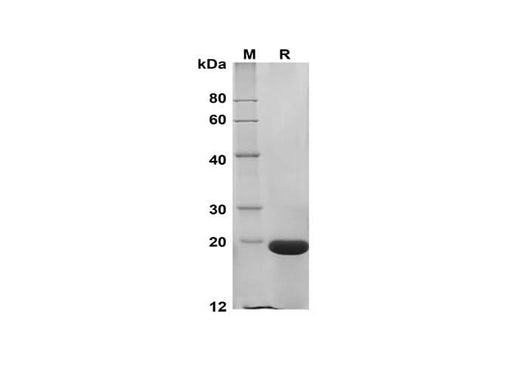 SDS-PAGE analysis of Human TNF β/LTA proteins, 2 μg/lane of Recombinant Human TNF β/LTA proteins was resolved with SDS-PAGE under reducing conditions, showing bands at 19 kDa.