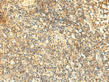 Immunohistochemistry of paraffin-embedded Human tonsil tissue using NAPRT Polyclonal Antibody at dilution of 1:50(×200)