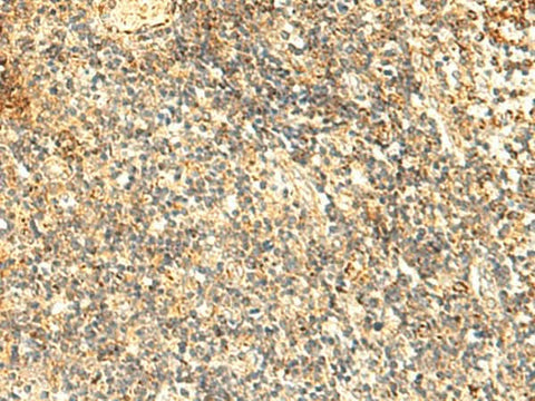 Immunohistochemistry of paraffin-embedded Human tonsil tissue using NAPRT Polyclonal Antibody at dilution of 1:50(×200)