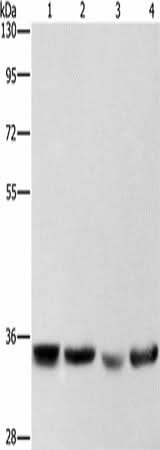 Anti-Human/Mouse AIMP1 Antibody - ABMIUM