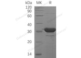 Recombinant Human HDHD2 Protein (His Tag) - ABMIUM