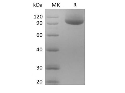 Recombinant Human Neuropilin-1/NRP1 (C-Avi-6His) Biotinylated - ABMIUM