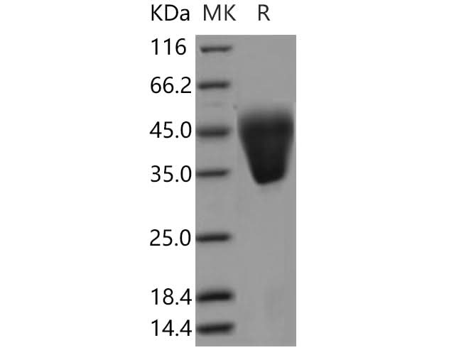Recombinant Human KCT2/C5orf15 Protein (His Tag) - ABMIUM