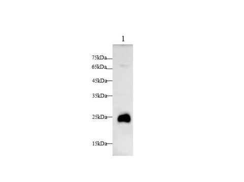 Anti-Human TREM1 Antibody - ABMIUM