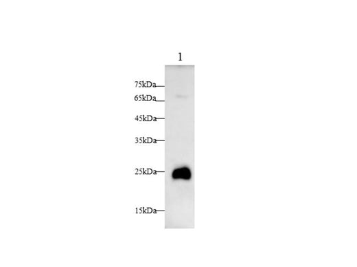 Anti-Human TREM1 Antibody - ABMIUM