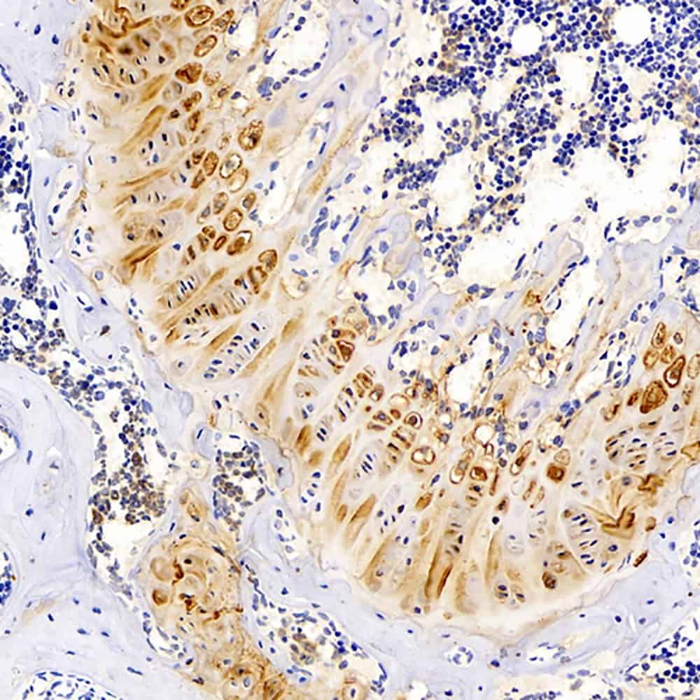 Immunohistochemistry analysis of paraffin-embedded mouse bone using MAGEC1 Polyclonal Antibody at dilution of 1:300.