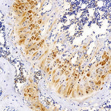 Immunohistochemistry analysis of paraffin-embedded mouse bone using MAGEC1 Polyclonal Antibody at dilution of 1:300.