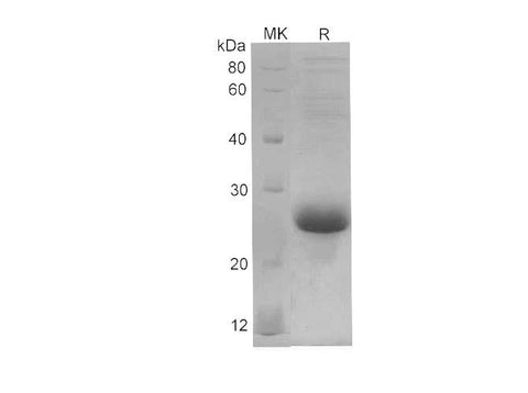 SDS-PAGE analysis of Human IL-6 proteins, 2 μg/lane of Recombinant Human IL-6 proteins was resolved with SDS-PAGE under reducing conditions, showing bands at 25-28 kDa.