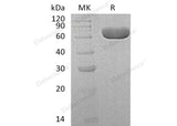 Recombinant Human SIAE Protein (Human Cells, His Tag) - ABMIUM