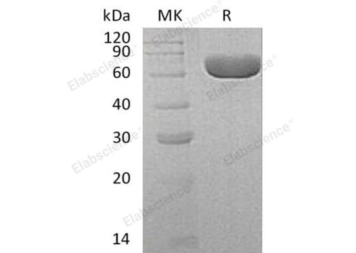 Recombinant Human SIAE Protein (Human Cells, His Tag) - ABMIUM
