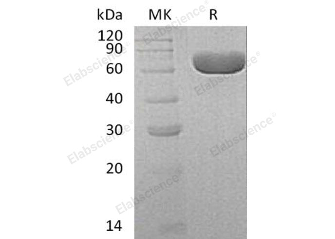 Recombinant Human SIAE Protein (Human Cells, His Tag) - ABMIUM