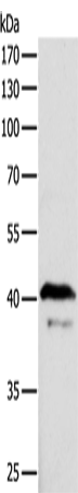 Anti-Human/Mouse ADAP1 Antibody - ABMIUM