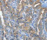 Anti-Human MUC15 Antibody - ABMIUM