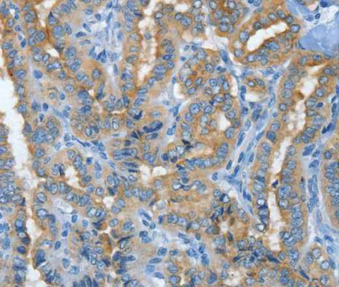 Anti-Human MUC15 Antibody