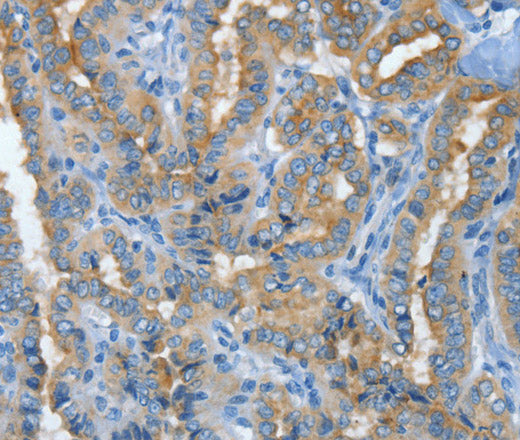 Anti-Human MUC15 Antibody - ABMIUM
