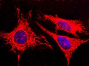 Anti-Human AK4 Antibody [B346] - ABMIUM