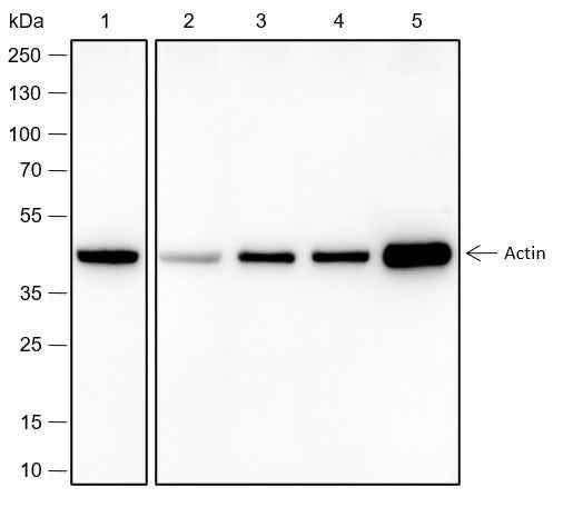 Anti-Human/Rat/Mouse Alpha Skeletal Muscle Actin Antibody [A509] - ABMIUM