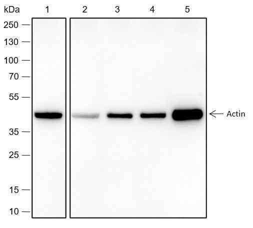 Anti-Human/Rat/Mouse Alpha Skeletal Muscle Actin Antibody [A509]